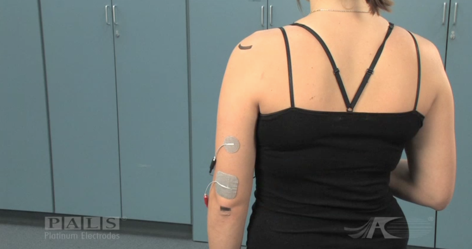 electrode placement for russian electrical stimulation for shoulder and  elbow - Yahoo Image Search Results