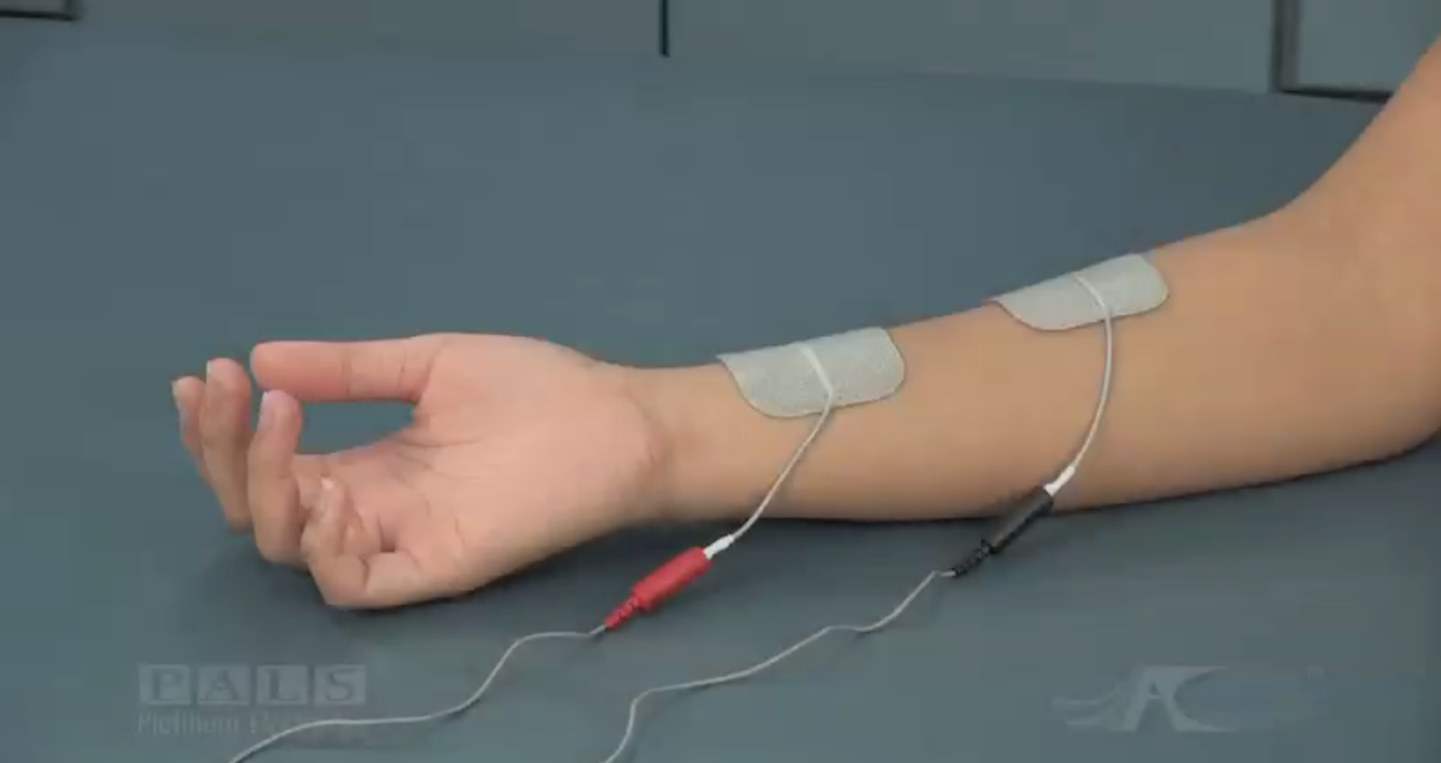 Guide to electrical stimulation therapy for stroke patients 